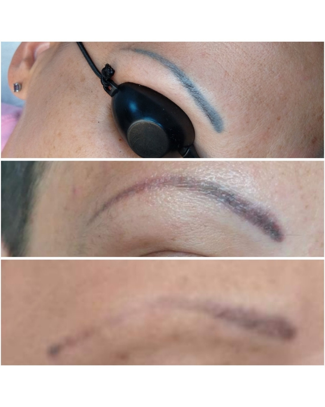 LaserTime Salontech eredmény képek