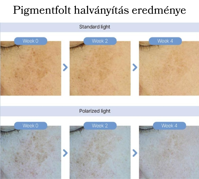 NXC KOREAI NAD+ Szérum Exoszóma+PDRN+Kollagén+Peptid tartalommal professzionális használatra 1 doboz 5+5 ampulla NXC KOREAI NAD+ Szérum Exoszóma+PDRN+Kollagén+Peptid tartalommal professzionális használatra 1 doboz 5+5 ampulla