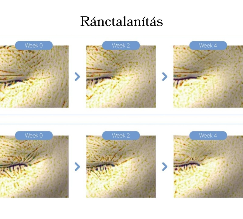 NXC KOREAI NAD+ Szérum Exoszóma+PDRN+Kollagén+Peptid tartalommal professzionális használatra 1 doboz 5+5 ampulla NXC KOREAI NAD+ Szérum Exoszóma+PDRN+Kollagén+Peptid tartalommal professzionális használatra 1 doboz 5+5 ampulla